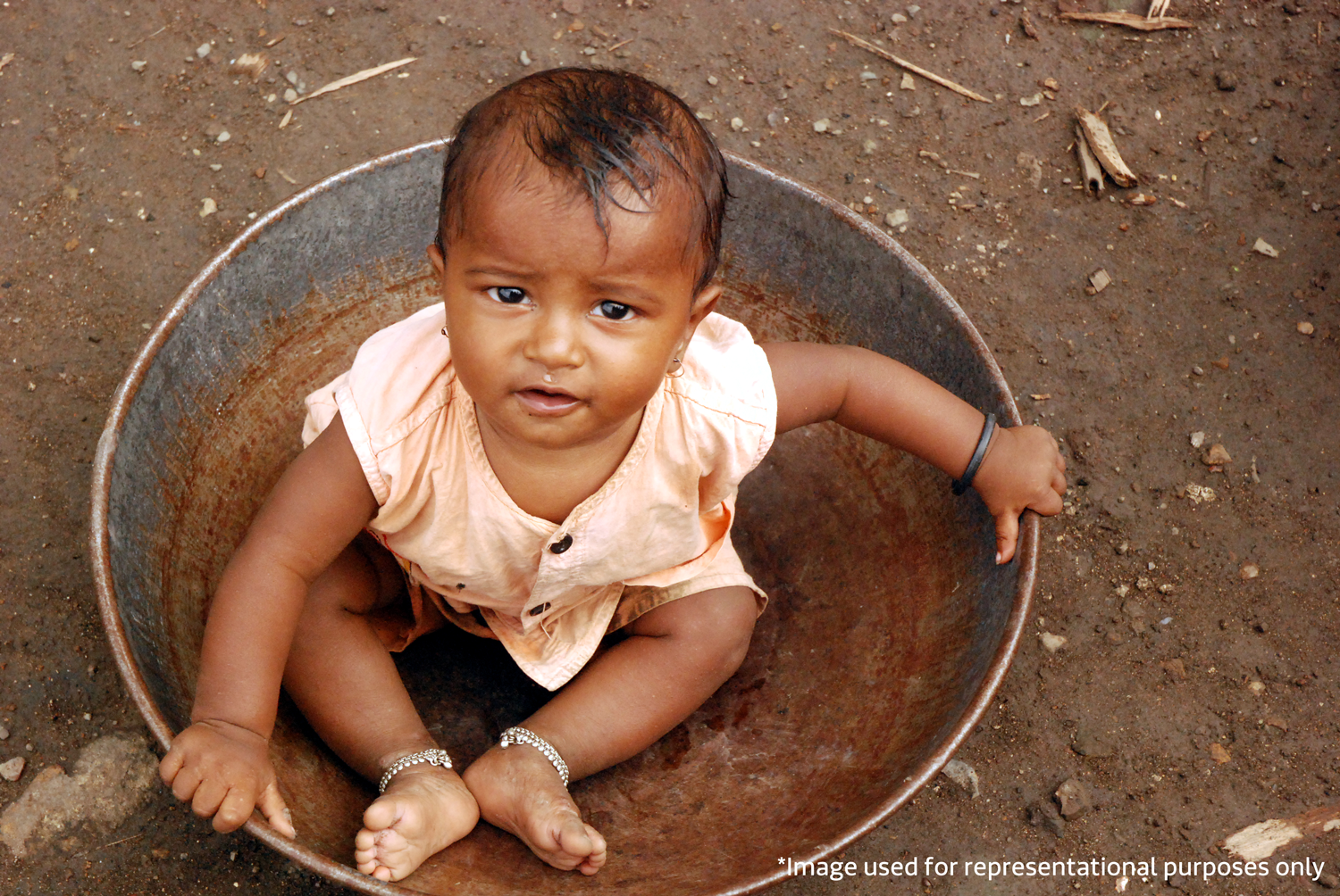 malnutrition in India